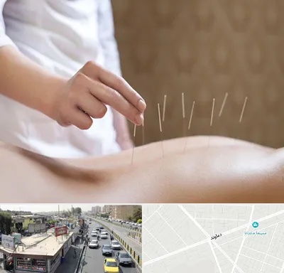 درای نیدلینگ در خیابان دماوند