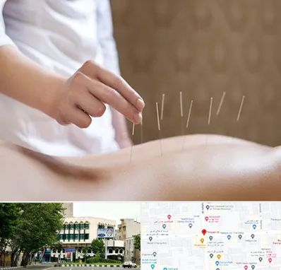 درای نیدلینگ در طالقانی 