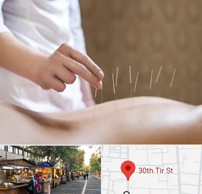 درای نیدلینگ در سی تیر