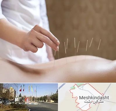 درای نیدلینگ در مشکین دشت