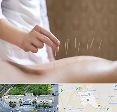 درای نیدلینگ در نسیم شهر