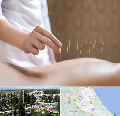 درای نیدلینگ در رودسر