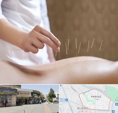 درای نیدلینگ در پرواز تبریز