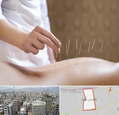 درای نیدلینگ در شمس آباد تهران