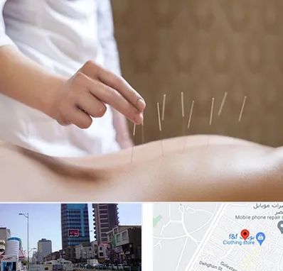 درای نیدلینگ در چهارراه طالقانی کرج 