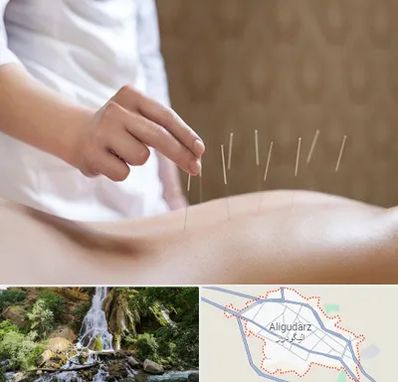 درای نیدلینگ در الیگودرز