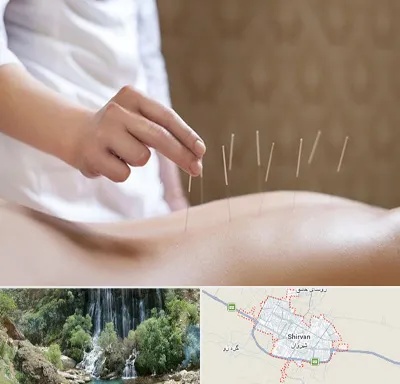 درای نیدلینگ در شیروان