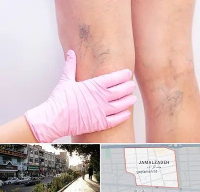 دکتر فوق تخصص واریس در خیابان جمالزاده
