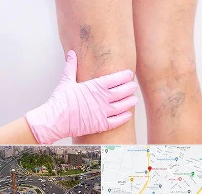 دکتر فوق تخصص واریس در سبلان 