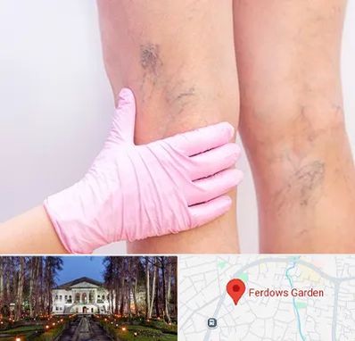 دکتر فوق تخصص واریس در باغ فردوس
