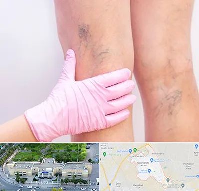 دکتر فوق تخصص واریس در نسیم شهر