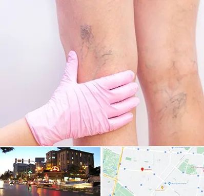 دکتر فوق تخصص واریس در بلوار سجاد مشهد 