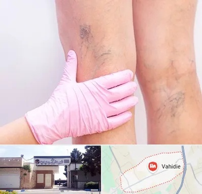 دکتر فوق تخصص واریس در وحیدیه شهریار