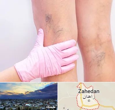 دکتر فوق تخصص واریس در زاهدان