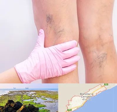 دکتر فوق تخصص واریس در بندرلنگه