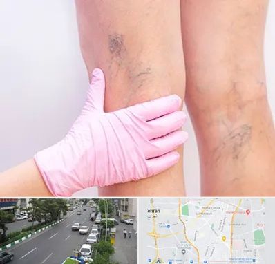 دکتر فوق تخصص واریس در ستارخان 