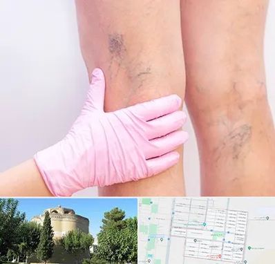 دکتر فوق تخصص واریس در مرداویج اصفهان 