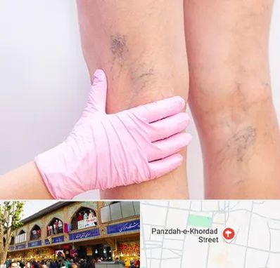 دکتر فوق تخصص واریس در 15 خرداد