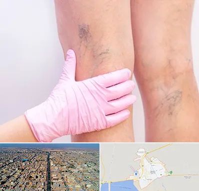 دکتر فوق تخصص واریس در بندر ماهشهر