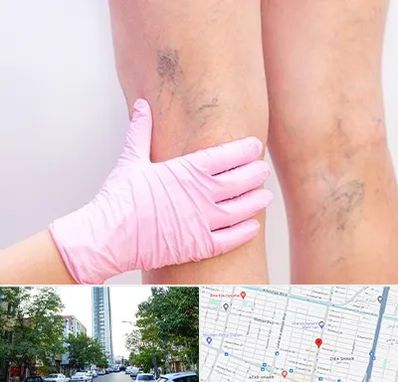 دکتر فوق تخصص واریس در امامت مشهد 