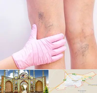 دکتر فوق تخصص واریس در سمنان