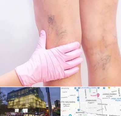 دکتر فوق تخصص واریس در جمهوری 