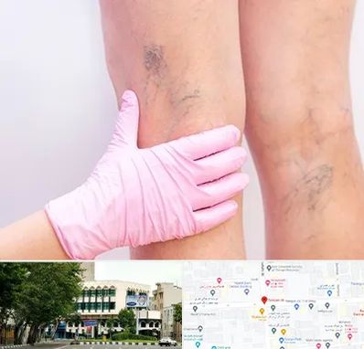 دکتر فوق تخصص واریس در طالقانی 