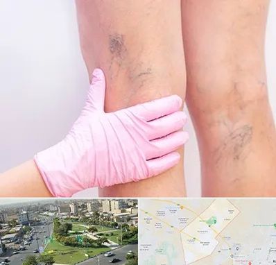 دکتر فوق تخصص واریس در کمال شهر کرج 