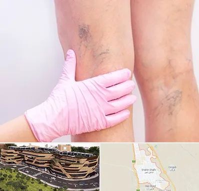 دکتر فوق تخصص واریس در شاهین شهر