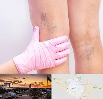 دکتر فوق تخصص واریس در قوچان