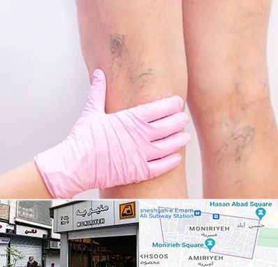 دکتر فوق تخصص واریس در منیریه 