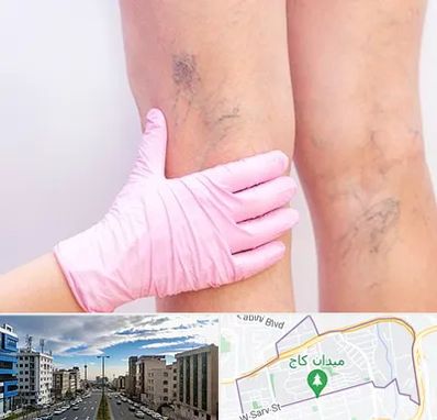 دکتر فوق تخصص واریس در سعادت آباد 