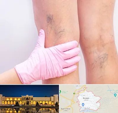 دکتر فوق تخصص واریس در برازجان