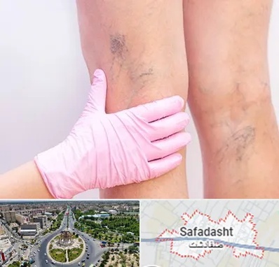 دکتر فوق تخصص واریس در صفادشت