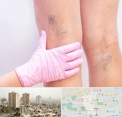 دکتر فوق تخصص واریس در منطقه 5 تهران 