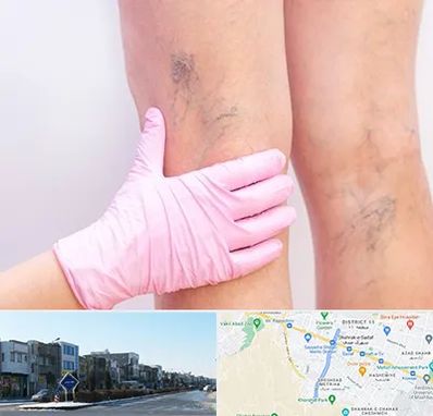 دکتر فوق تخصص واریس در شریعتی مشهد 