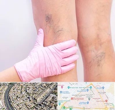 دکتر فوق تخصص واریس در شهرک غرب مشهد 