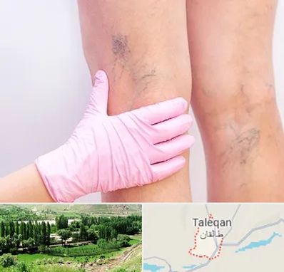 دکتر فوق تخصص واریس در طالقان