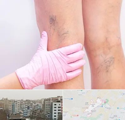 دکتر فوق تخصص واریس در محمد شهر کرج 