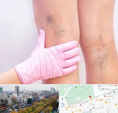 دکتر فوق تخصص واریس در بلوار کشاورز 