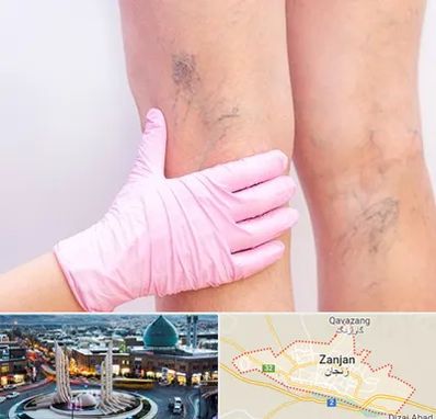 دکتر فوق تخصص واریس در زنجان