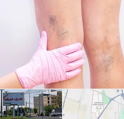 دکتر فوق تخصص واریس در فاز یک اندیشه
