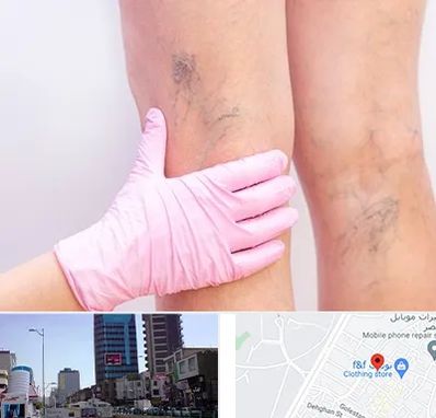 دکتر فوق تخصص واریس در چهارراه طالقانی کرج 