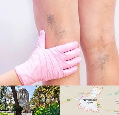 دکتر فوق تخصص واریس در نیشابور