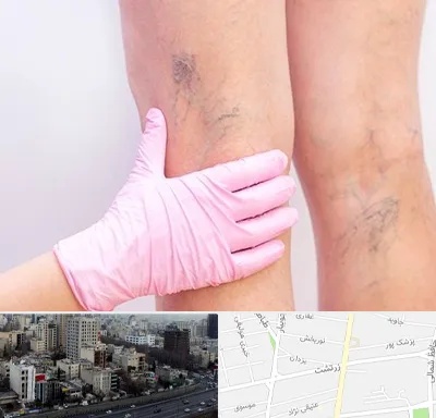 دکتر فوق تخصص واریس در زرتشت