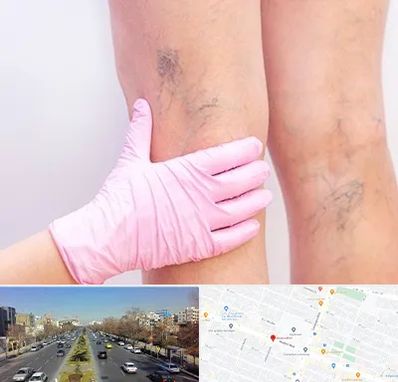 دکتر فوق تخصص واریس در بلوار معلم مشهد 