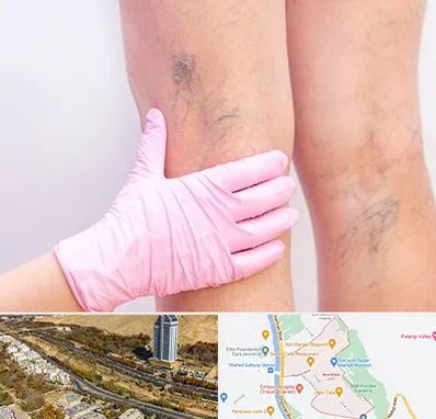 دکتر فوق تخصص واریس در خیابان نیایش شیراز 