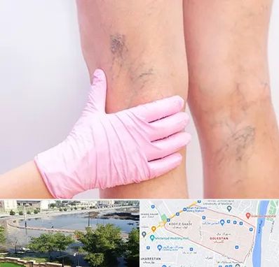 دکتر فوق تخصص واریس در گلستان اهواز 