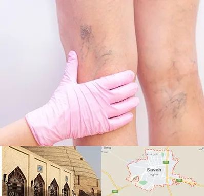 دکتر فوق تخصص واریس در ساوه