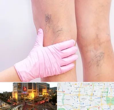 دکتر فوق تخصص واریس در جنت آباد تهران 